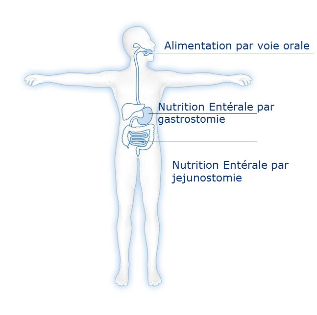 Enteral nutrition uses the gastrointestinal tract 