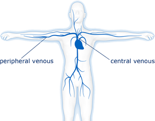 La nutrición parenteral 