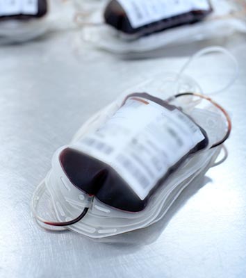 Transfusion Technology