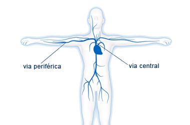 A nutrição parentérica evita o trato gastrointestinal